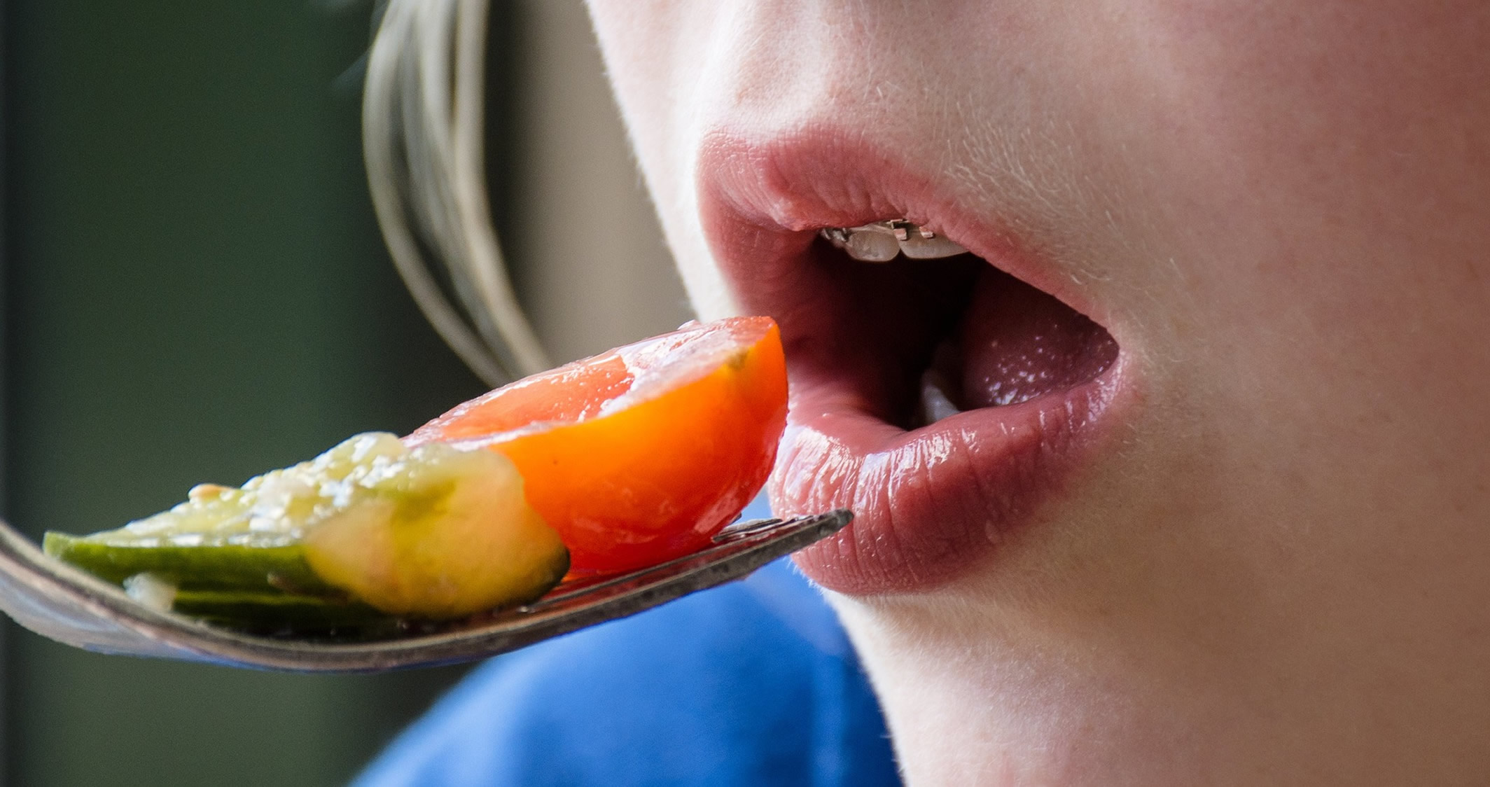 Alimentos permitidos con brackets ortodoncia Sevilla